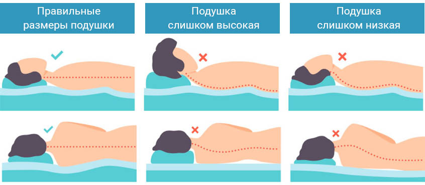 Как выбирать ортопедические подушки при остеохондрозе шейного отдела